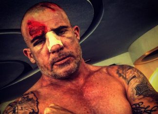 Prison Break | Dominic Purcell sofre grave acidente durante as filmagens da nova temporada